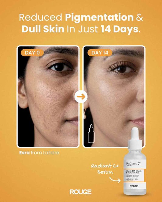 Radiant C+: Vitamin C Serum